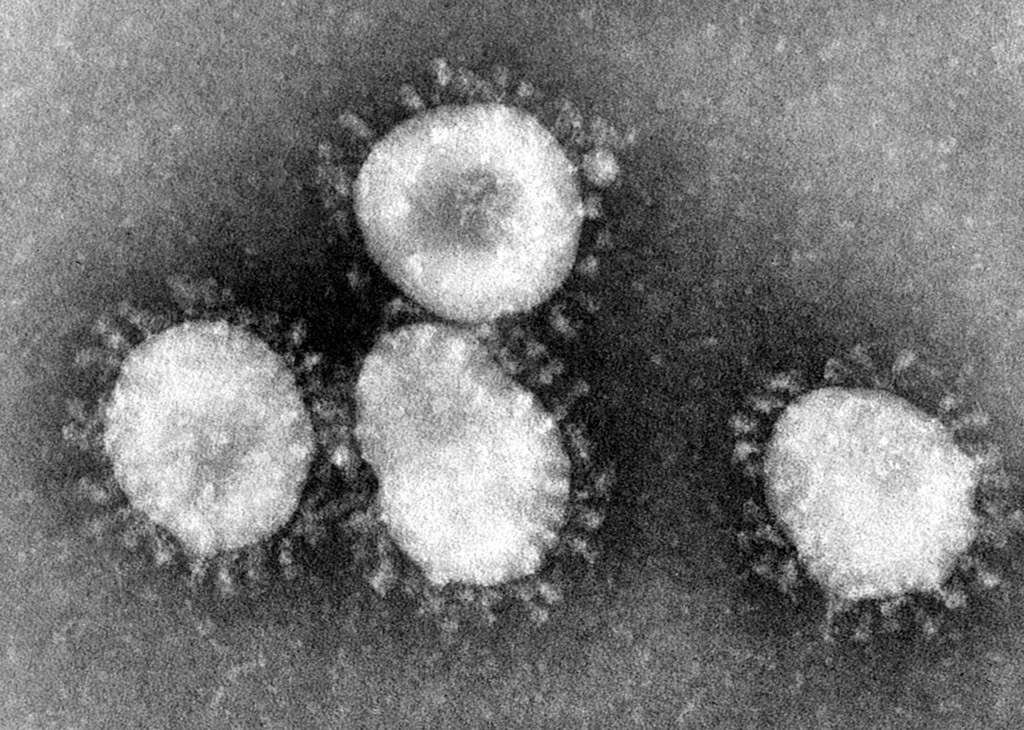 Coronaviruses electron view